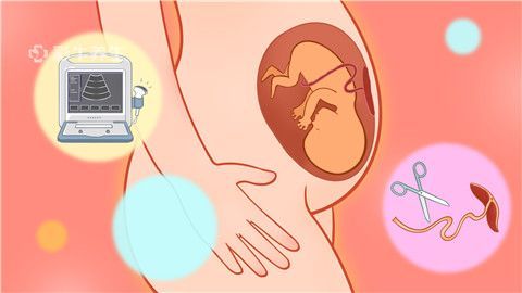 一般流产需要休息几天