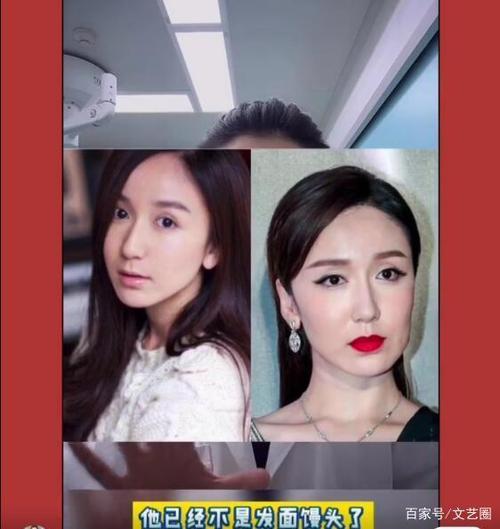 娄艺潇的脸怎么了?整形医生直言变丑的罪魁祸首是填充