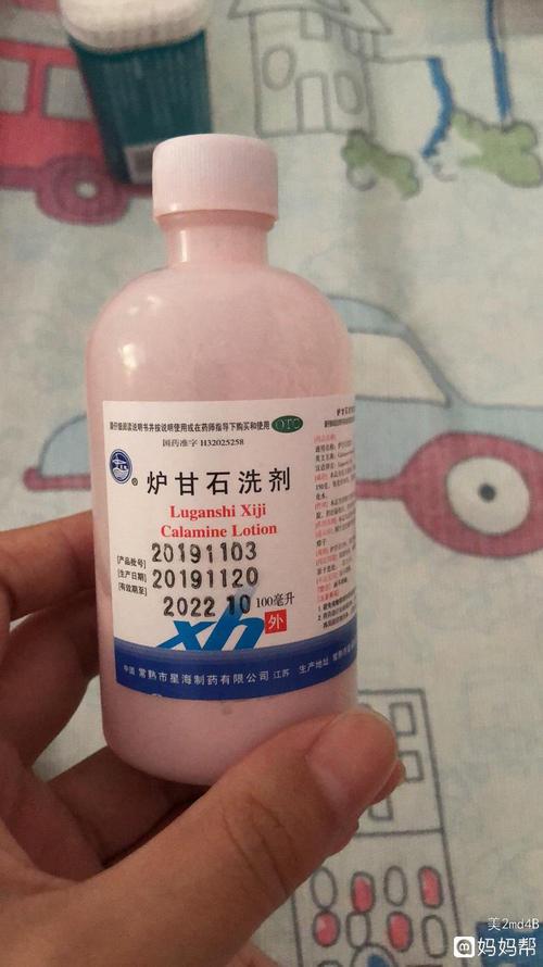 宝宝长痱子 用炉甘石洗剂 蚊子叮咬也