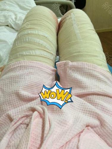 下了手术台绑着绷带