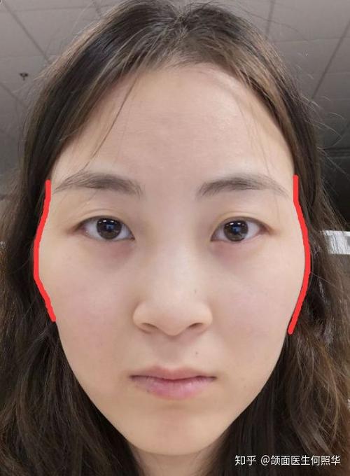 菱形脸高颧骨应该怎样改造呀?
