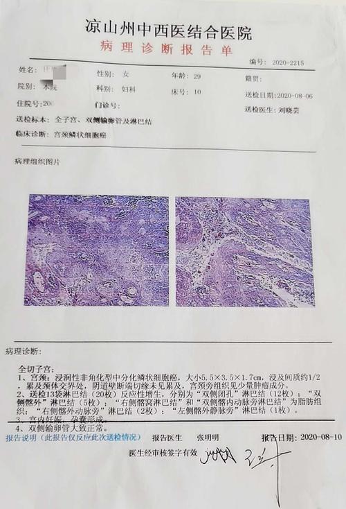 病检结果回示:宫颈浸润性非角化型中分化鳞状细胞癌.