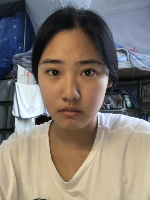 下巴圆嘴唇厚超级影响颜值 该怎么改变啊