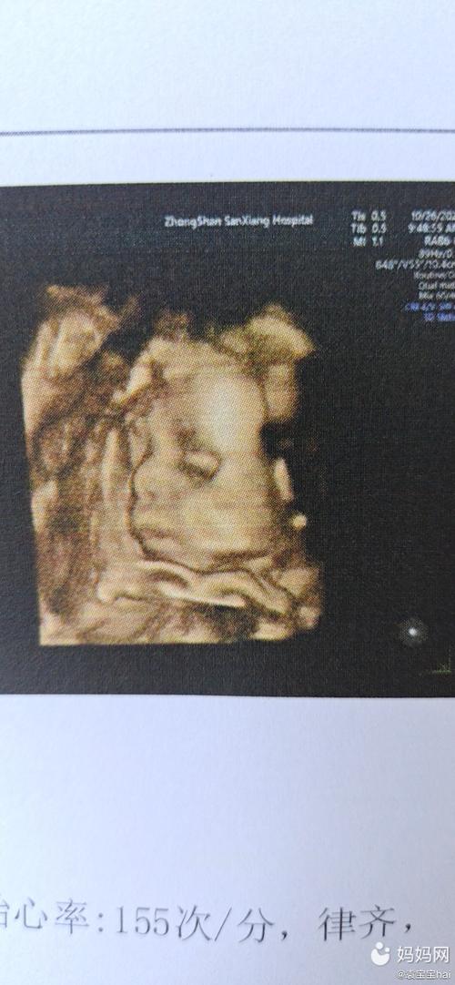 四维一次性过了!小小的你,和爸爸长这么像!