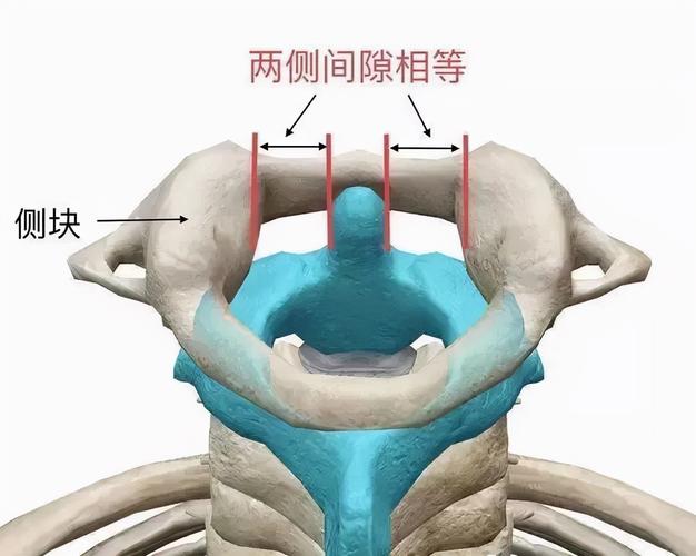 (正常状态)(旋转半脱位)寰枢关节是脊柱椎体中活动度最大的关节,是