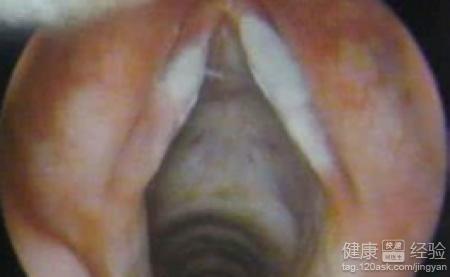症状越来越严重,今天我们就来分享女性外阴白斑的疾病,用什么办法可以