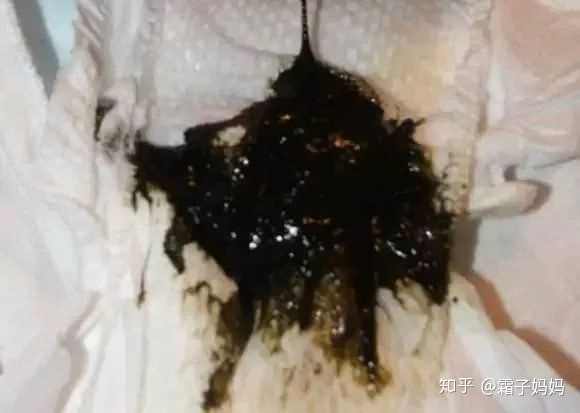 宝宝四个月多,纯奶粉喂养,大便呈绿色是什么原因?