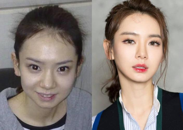 娱乐圈有哪些成"整容标杆"的明星?虽然人糊,但颜值是真的高