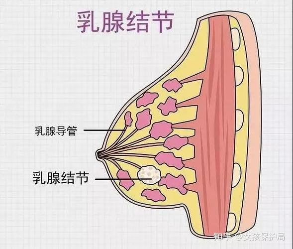 体检结果大曝光!10个女性8个乳腺结节,还能买保险吗?