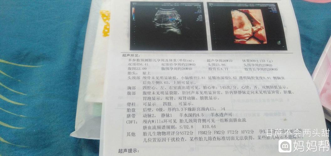 我四维单子显示三条线,医生说是男宝,伤心