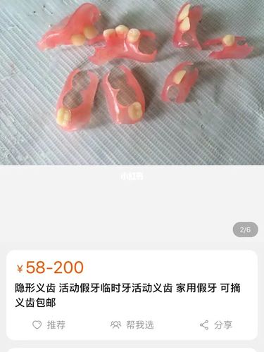 活动义齿好用吗?