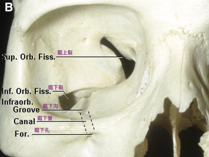 显示眶下裂,眶下沟,眶下管和眶下孔.