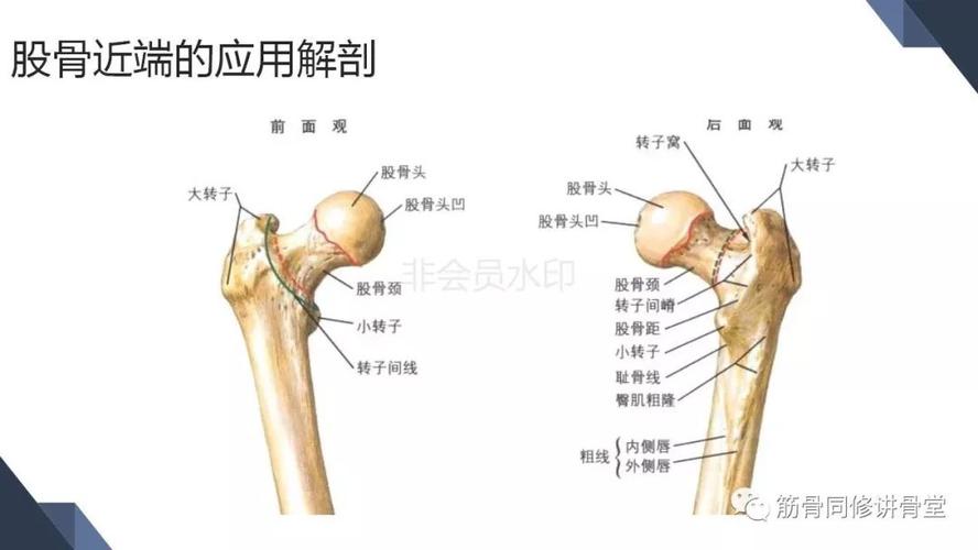 合并大转子冠状位骨折的股骨近端骨折的治疗