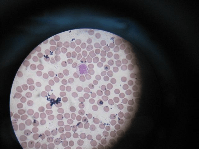 血涂片制作和白细胞分类/abo血型鉴定