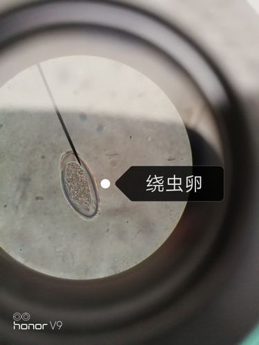 寄生虫卵~显微镜 绕虫卵钩虫卵