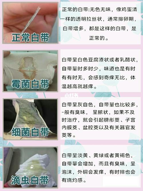 白带这样我真的是怕了,下面异味瘙痒!