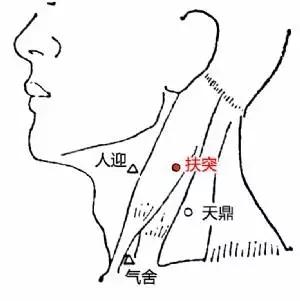 针灸治疗慢性咽炎