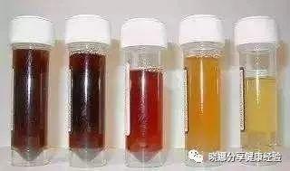 泌尿外科医生提示晨尿是这个颜色的人恭喜你你的肝肾很好