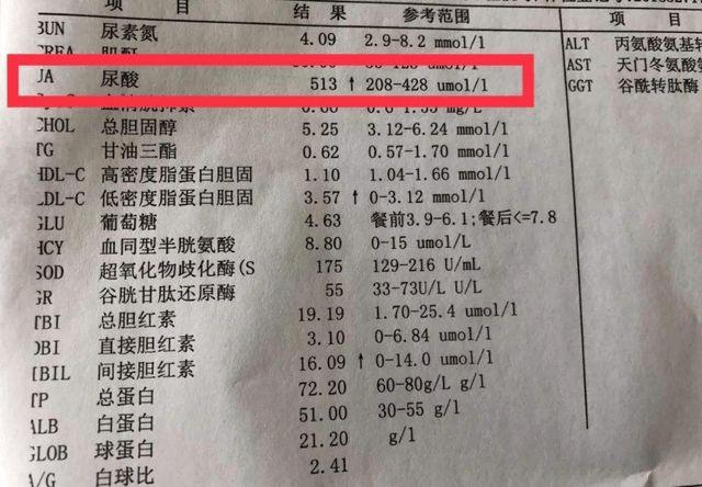 尿液尿酸,正常范围:成人为90-420umol/l血清尿酸,正常范围:男性为149