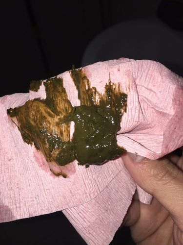 请问怎么判断黑便