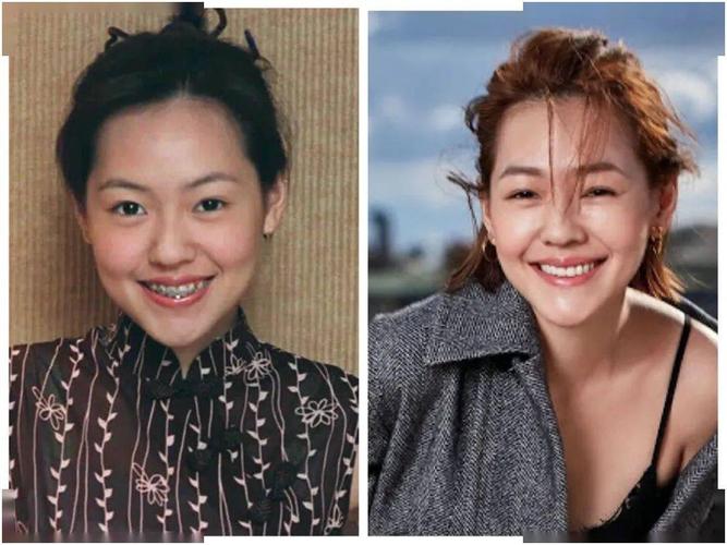 为此,她还专门写了一本书《小 s 牙套日记》.