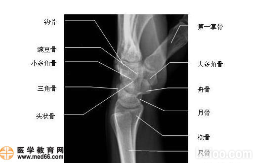 需摄取腕关节尺偏位――腕部外展正位的是 a.掌骨骨折