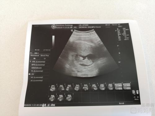 十一周b超 - 2020年11月预产期帮 - 妈妈帮