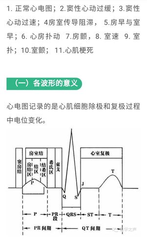 人人看懂心电图