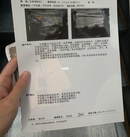 甲状腺b超报告_甲状腺_b超_甲状腺结节_医疗健康_医疗