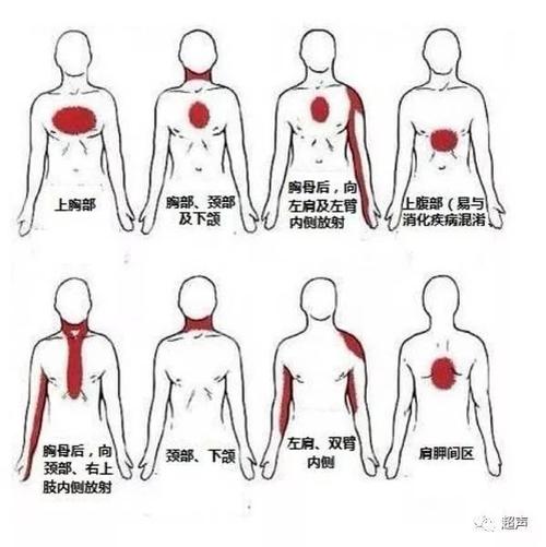 心前区图片大全