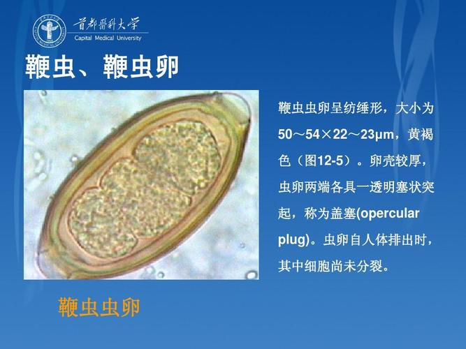 临床医学 实用临床医学检验形态学之寄生虫图谱分析ppt  鞭虫,鞭虫卵
