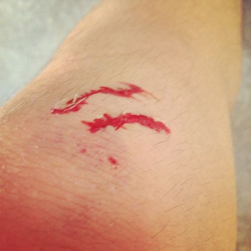 我今天脚撞流血了然后去我朋友家他爷爷就拿驱风油