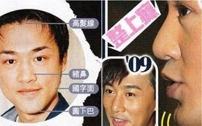林峰前后对比照曝光,被疑为整容!元芳,你怎么看?