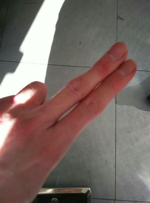 食指和中指之间有缝隙闭合不严对学习美发有影响吗