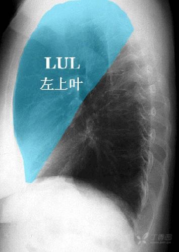 秒懂胸片!扒一扒胸片的基础知识