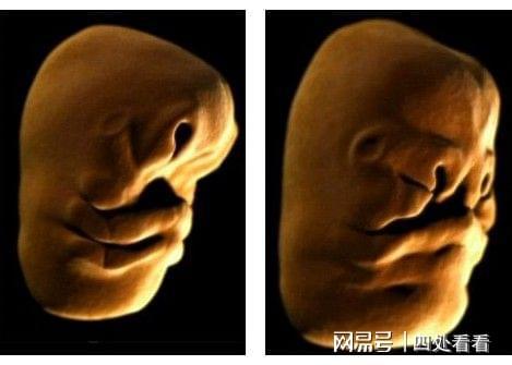 人类面孔如何形成:英国拍摄胎儿面部发育过程