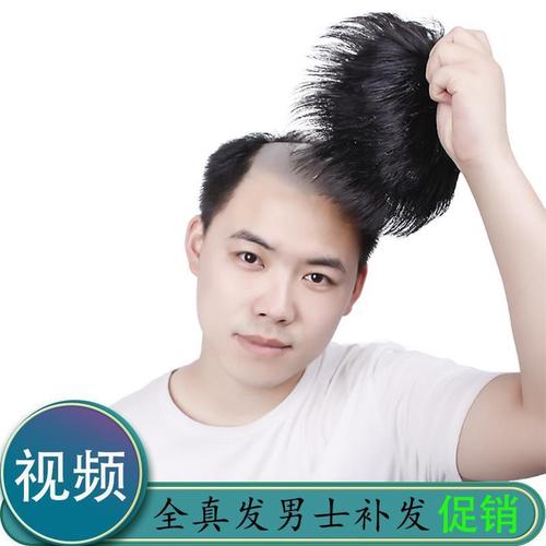 男士假发寸头补发片假发套头顶补发前额秃顶补发垫翻盖真发男发块