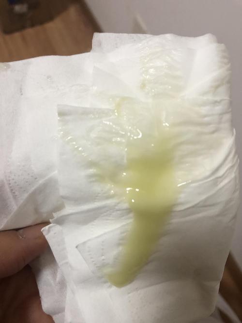 白带是这个颜色是什么原因啊