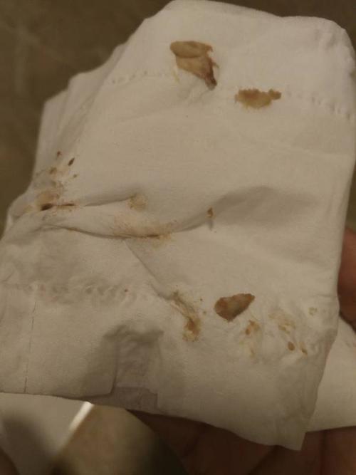 五分钟前开始来血,不知道是不是月经. 女,23岁!