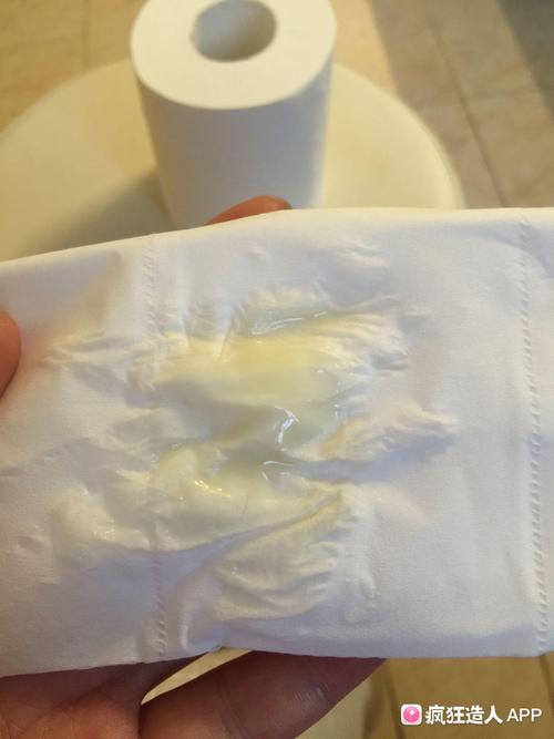 8周了,现在白带怎么这样?(有图慎入)