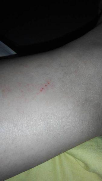 象是牙印红红的!下边第一个还有点血似的