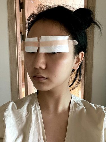 现在主要以休息为主,等一会要去医院换药,然后就可以把这个纱布取了