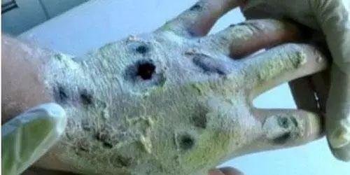 "安全,不成瘾"? 第三代毒品害你没商量