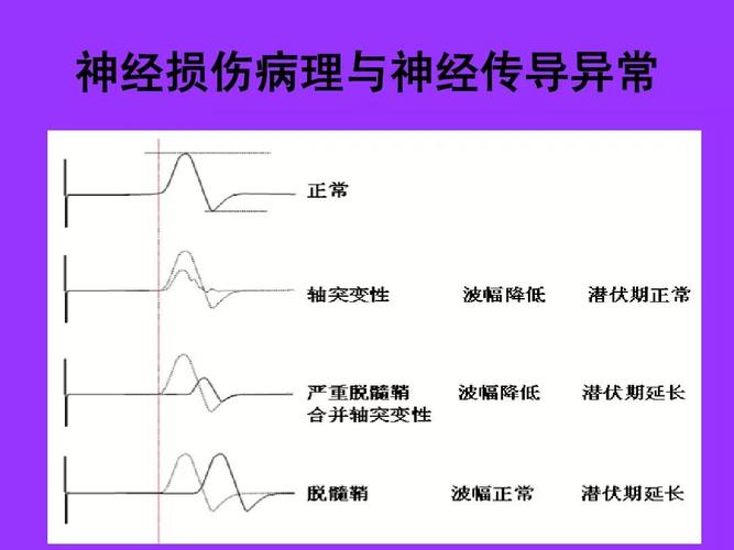 金昌市中西医结合医院肌电