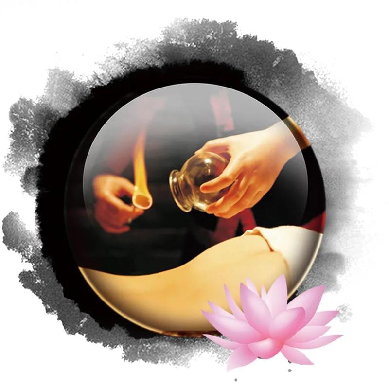 中医护理拔罐你了解吗