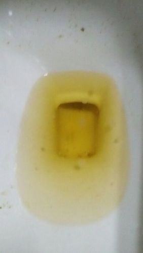 请问这是蛋白尿吗