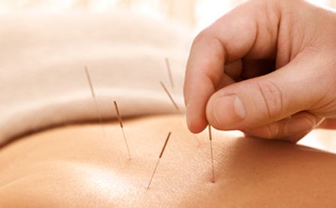 针灸减肥存在的认识误区你真的了解吗