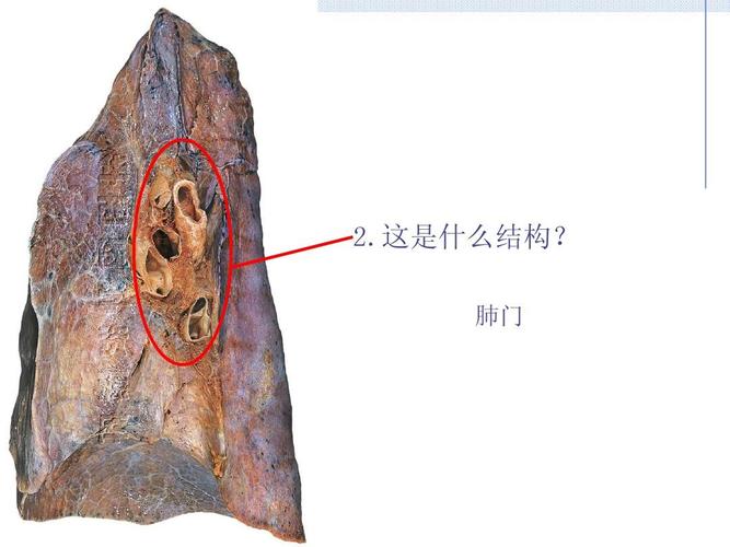 肺门  