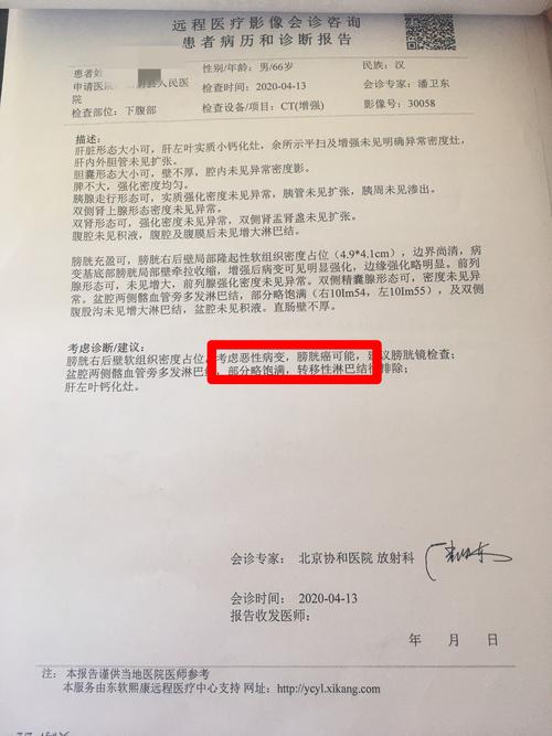 经超声和下腹部ct检查,远程邀请北京协和医院专家会诊,均考虑膀胱癌