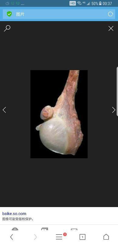 这睾丸图片是否正常